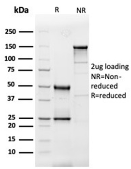 IL3 Antibody