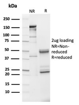 IGFBP3 Antibody
