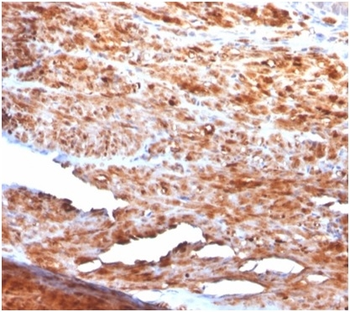 DES Antibody