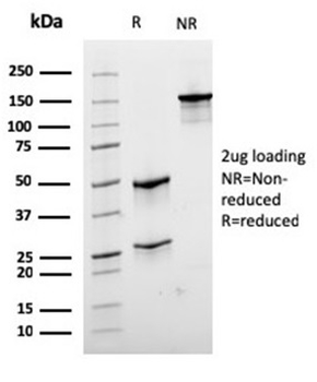 DES Antibody