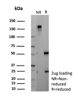 CFTR Antibody
