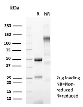 CFTR Antibody