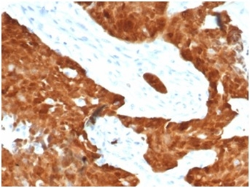 CDKN2A Antibody