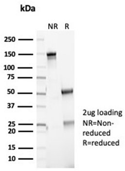 CDKN2A Antibody