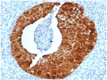 CDKN2A Antibody