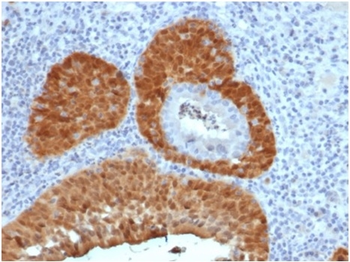 CDKN2A Antibody