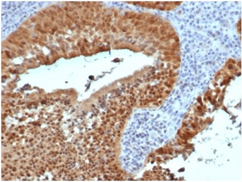 CDKN2A Antibody