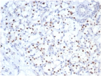 CDKN1C Antibody
