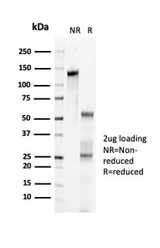 CDKN1C Antibody