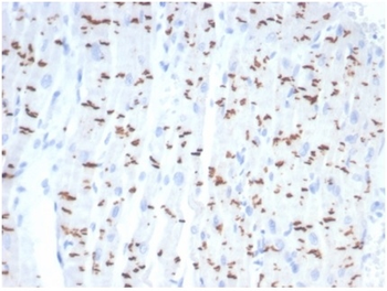 CDH2 Antibody