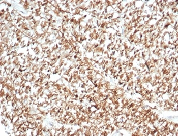 CALB2 Antibody