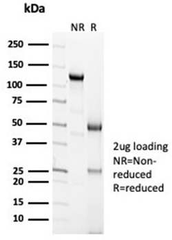 CALB2 Antibody