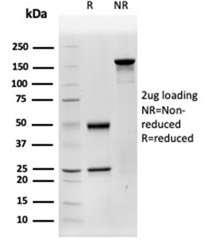 CTSD Antibody