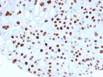 CDKN1A Antibody