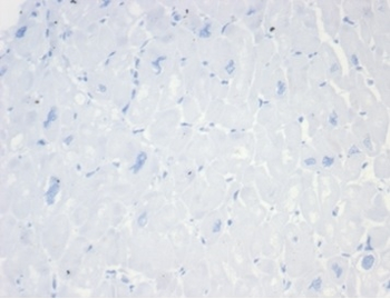 MS4A1 Antibody