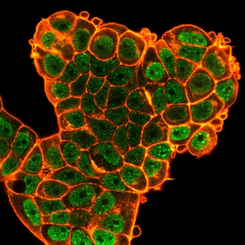 BCL6 Antibody