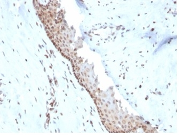 NME1 Antibody