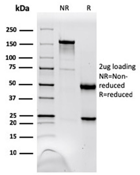 NME1 Antibody