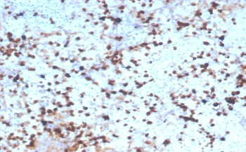 GZMB Antibody
