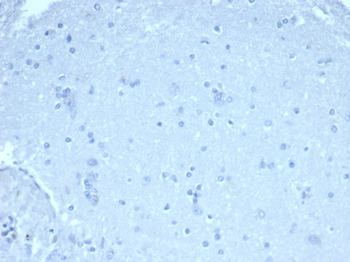 FOXP1 Antibody