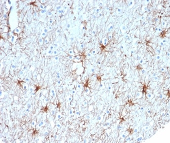 GFAP Antibody