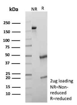 GFAP Antibody