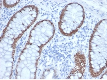 SATB2 Antibody
