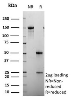 SATB2 Antibody