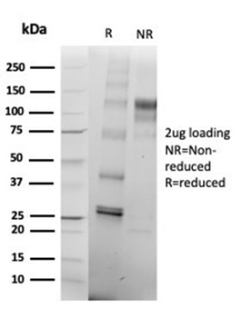 SATB2 Antibody