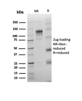 DNTT Antibody