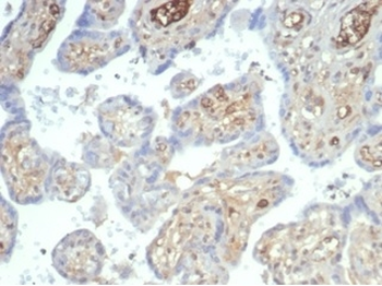 AFP Antibody