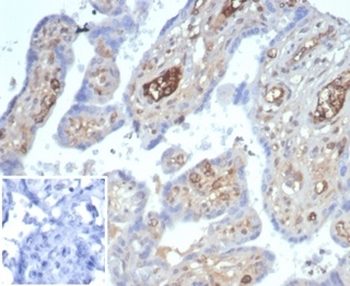 AFP Antibody
