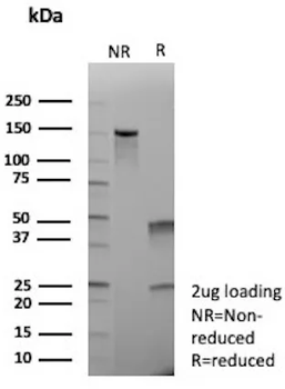 AFP Antibody