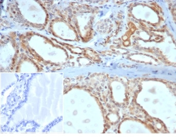 DAXX Antibody