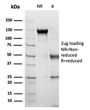 SERPINA3 Antibody