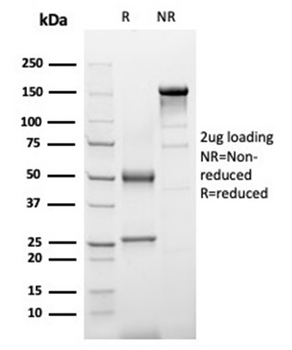 SERPINA3 Antibody