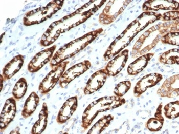 CDH16 Antibody