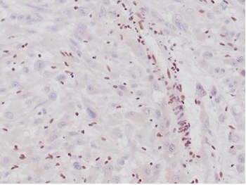 SMARCB1 Antibody