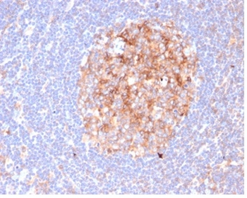 CD86 Antibody