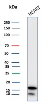 FABP3 Antibody