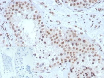 NR5A1 Antibody