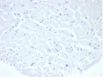 ALPP Antibody