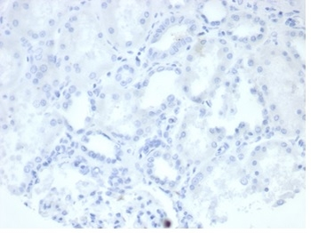 ALPP Antibody