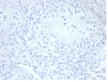 ALPP Antibody