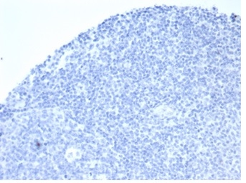 ALPP Antibody