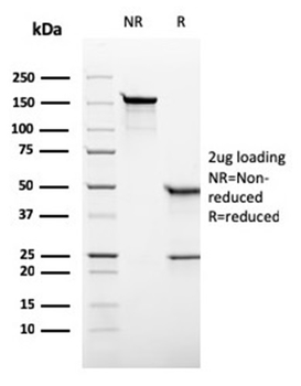 ALPP Antibody