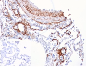 FGF21 Antibody