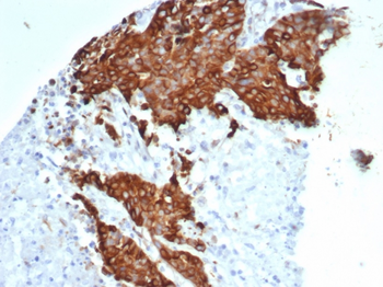 TUBB3 Antibody