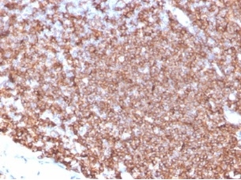 MS4A1 Antibody