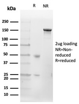 MS4A1 Antibody